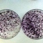 Algunas proteínas de HCV